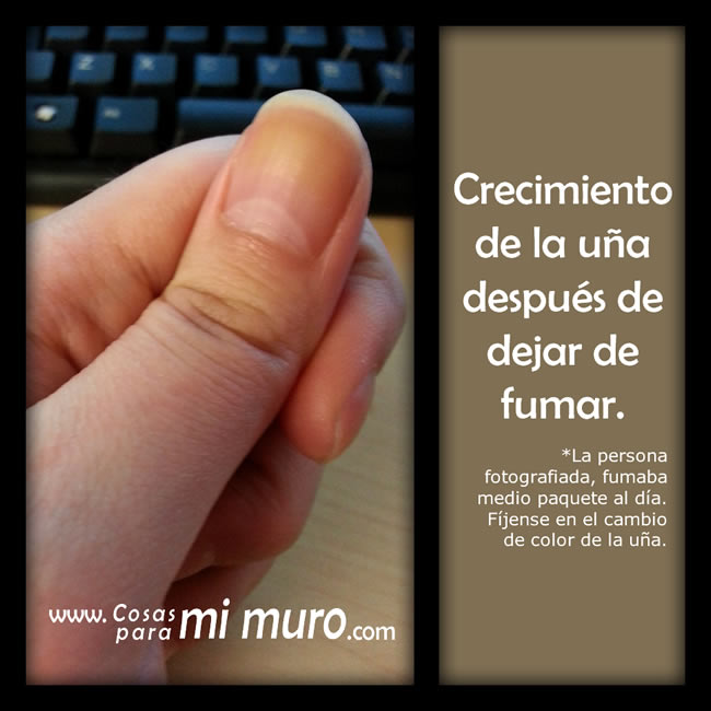 Crecimiento de la u&ntilde;a despu&eacute;s de dejar de fumar